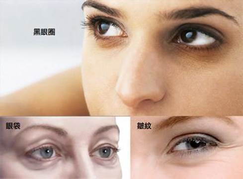 如何去眼袋和黑眼圈，揭曉什么眼霜去眼袋黑眼圈效果最好