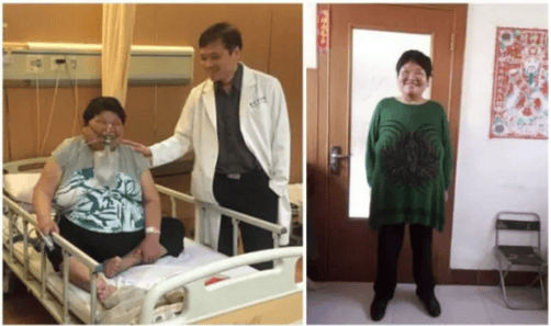秀域集團總顧問黃致錕：減重手術為什么有效
