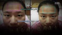 朵妍清祖?zhèn)髦兴幟婺?祛斑價(jià)格西紅柿祛斑的小竅門面部黃褐斑