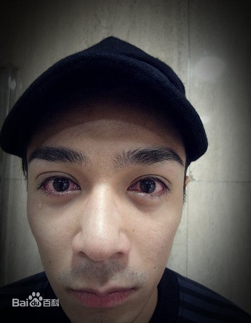 http://www.omega3-ala.com/pics/star/pic/62fe2ed9a02b1d441ba0830e462e937e.jpg